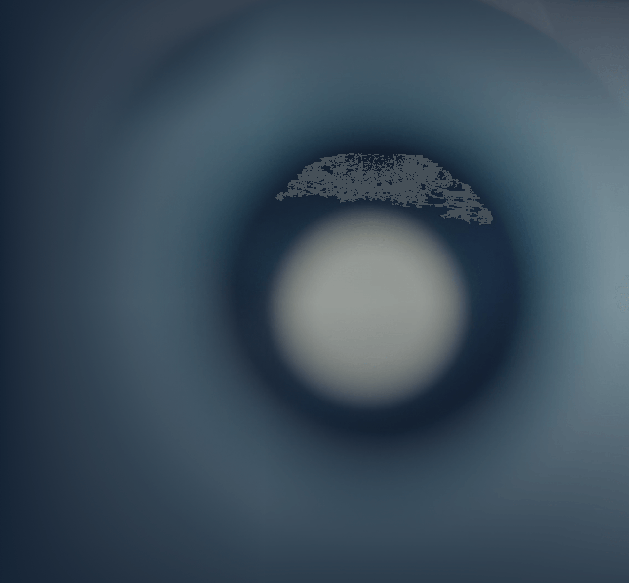 Cataract Screening